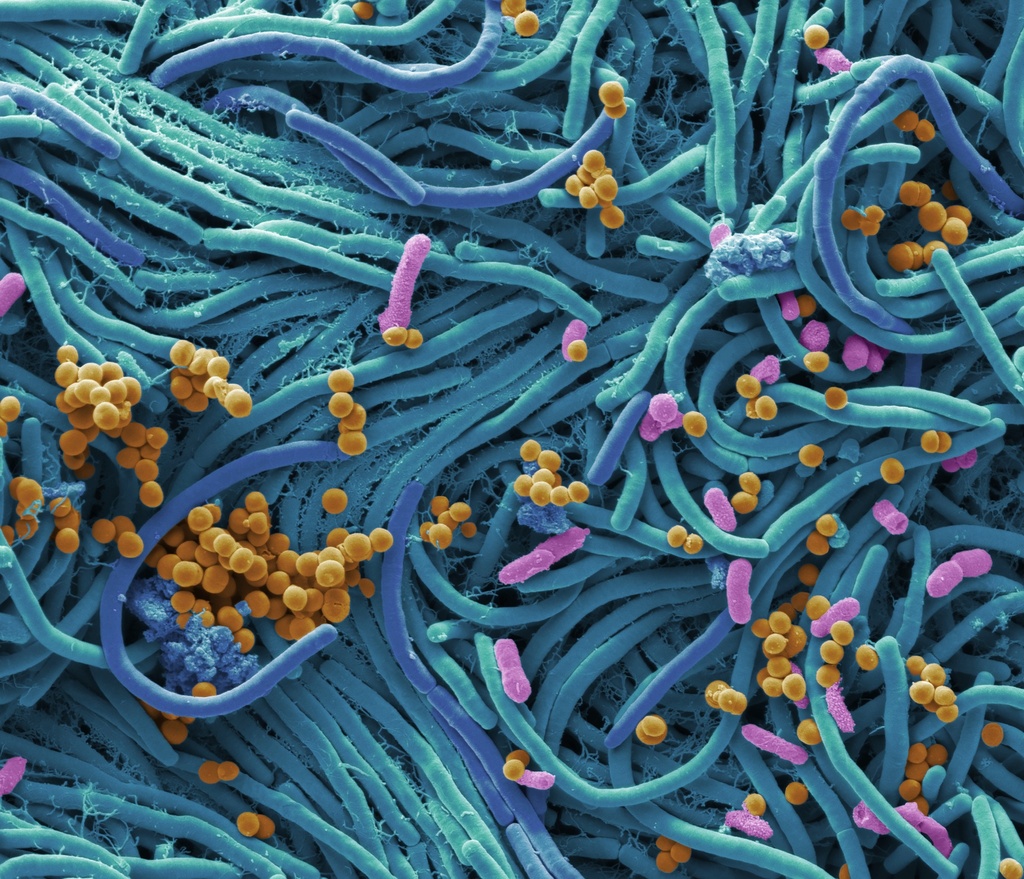 Microbiote : les opportunités de marché pour les acteurs de santé